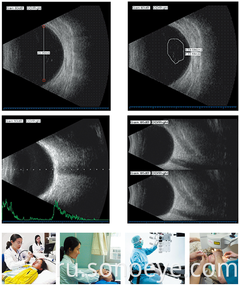 image for Ophthalmic A/B Scanner